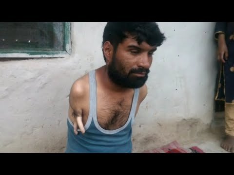 Doda: Handicapped from both hands; a brother with two orphan sisters