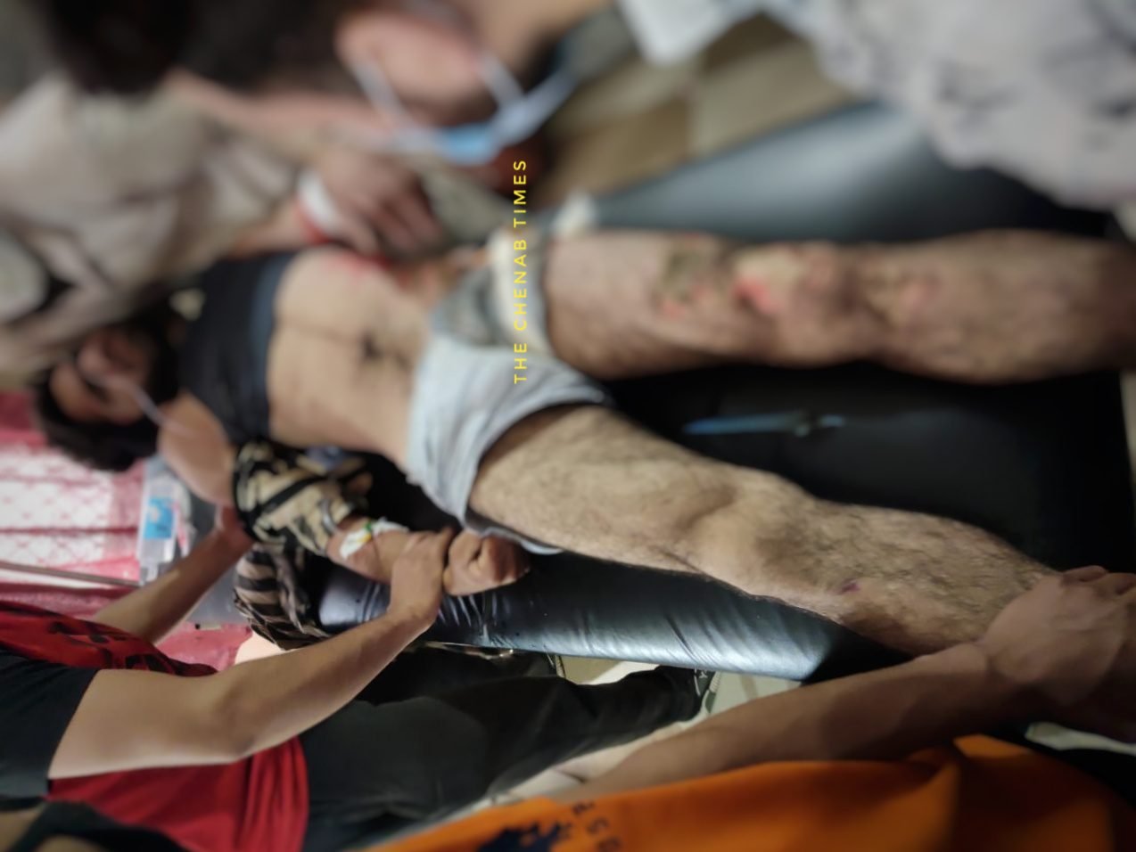 Two young boys electrocuted after HT lines falls in Doda