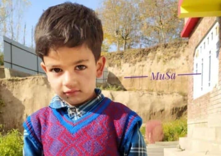 Kashmir: Kulgam minor boy dies at SKIMS two days after falling off slab