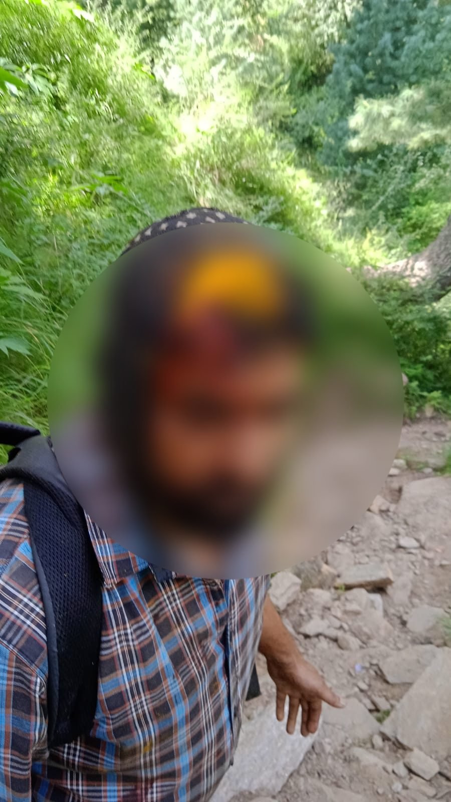 Doda: Forest Official Sustains Severe Head Injury During Violent Confrontation in Anti-Encroachment Operation in Chiralla Forest Range