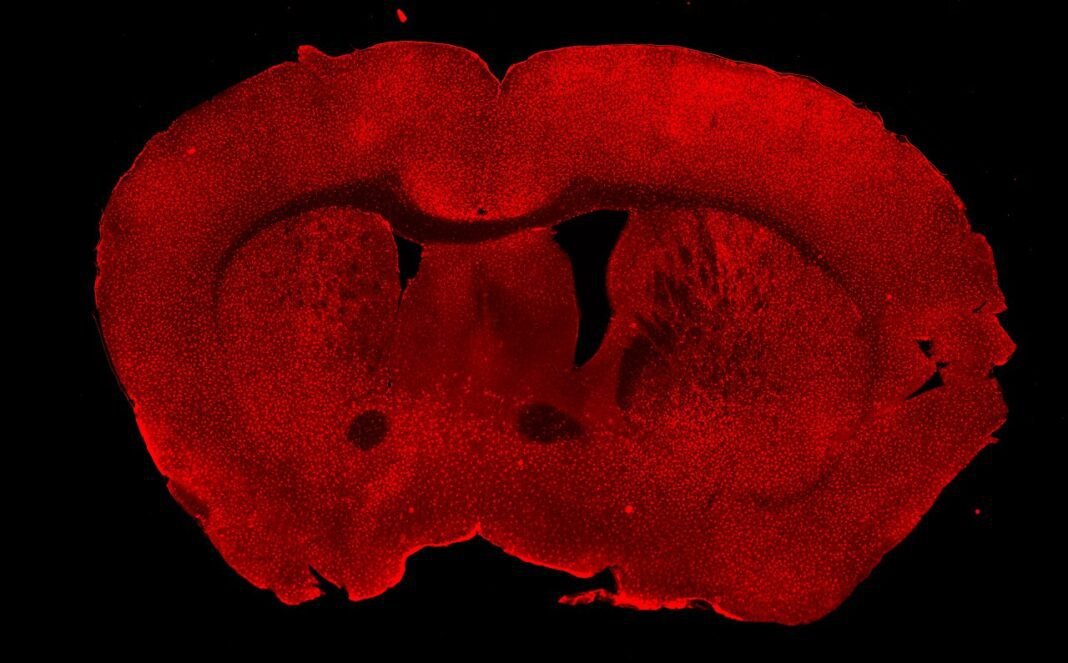 New Delhi Study Links Brain Immune Cells’ Calcium to Anxiety Behaviours In this image, immunohistochemistry was performed on a mouse brain coronal section. Microglia were labeled in red using an Iba1 primary antibody followed by a fluorescent secondary antibody. The sect…