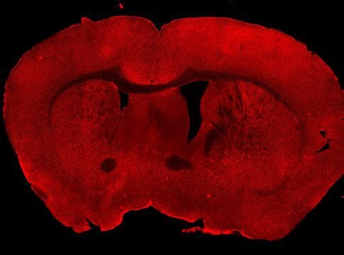 In this image, immunohistochemistry was performed on a mouse brain coronal section. Microglia were labeled in red using an Iba1 primary antibody followed by a fluorescent secondary antibody. The sect…
