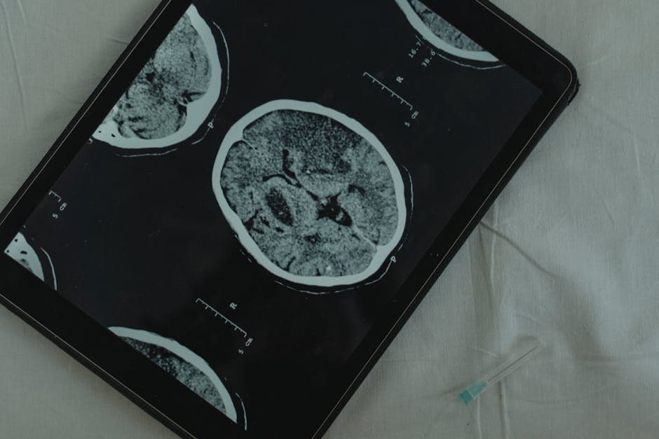 India Heatwave Exacerbates Neurological, Ocular Ailments; Experts Urge Precautions Close-up view of a brain CT scan displayed on a digital tablet with a medical needle beside it.