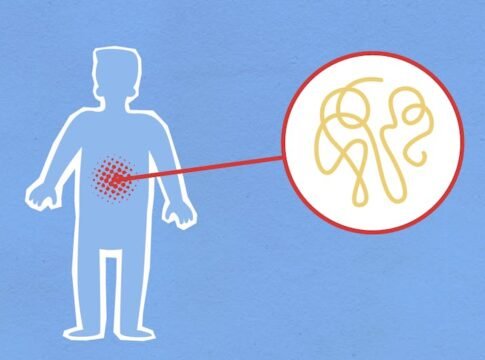 Cutout paper composition representing sick human figure with viral infection in stomach on blue background Cutout paper composition representing sick human figure with viral infection in stomach on blue background