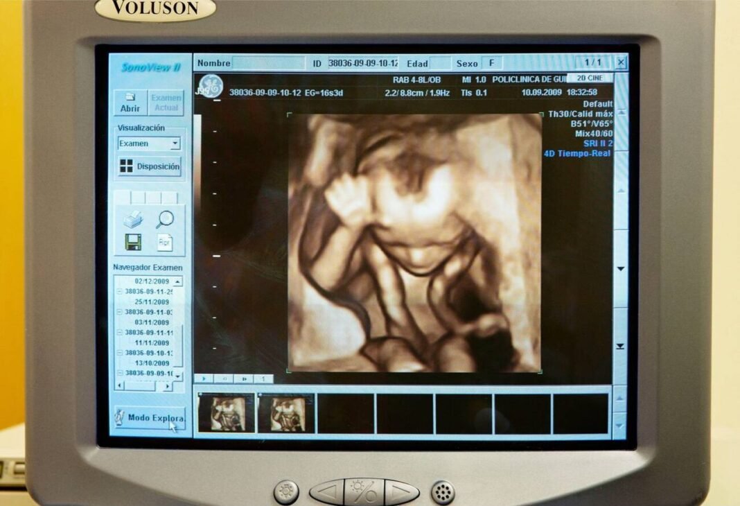 Maharashtra Stillbirths Persist Despite High Institutional Delivery Rates, Study Reveals A medical monitor displaying 3D and 4D obstetric ultrasound imaging, utilized for the detailed anatomical visualization of fetal structures and real-time fetal movement. This diagnostic modality is i…