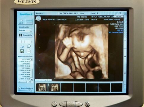 A medical monitor displaying 3D and 4D obstetric ultrasound imaging, utilized for the detailed anatomical visualization of fetal structures and real-time fetal movement. This diagnostic modality is i… A medical monitor displaying 3D and 4D obstetric ultrasound imaging, utilized for the detailed anatomical visualization of fetal structures and real-time fetal movement. This diagnostic modality is i…