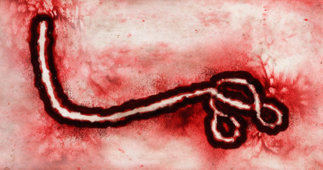 Uganda Town That Gave Ebola Its Name Battles New Outbreak in Neighboring Congo Ebolavirus under a microscope.