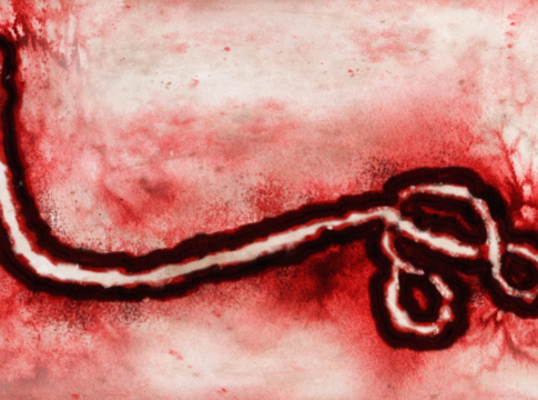 Ebolavirus under a microscope. Ebolavirus under a microscope.