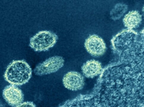 Electron micrograph of 1918 H1N1 influenza virus particles near a cell. Credit: NIAID
