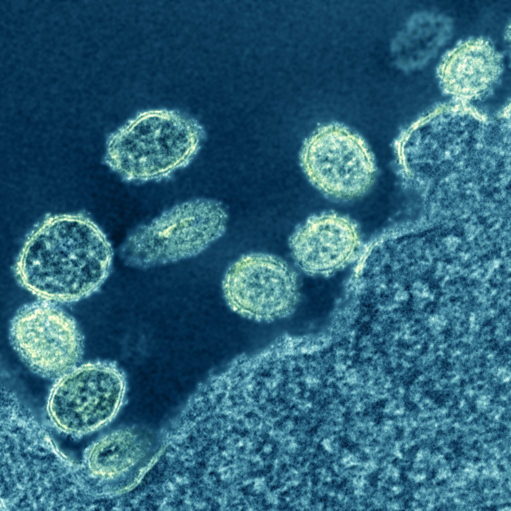 Delhi Sees Surge in H1N1 and Dengue Cases Amid Humid Weather Electron micrograph of 1918 H1N1 influenza virus particles near a cell. Credit: NIAID