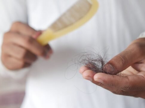 A detailed image showing hair loss with a comb in hand, symbolizing alopecia and related issues.