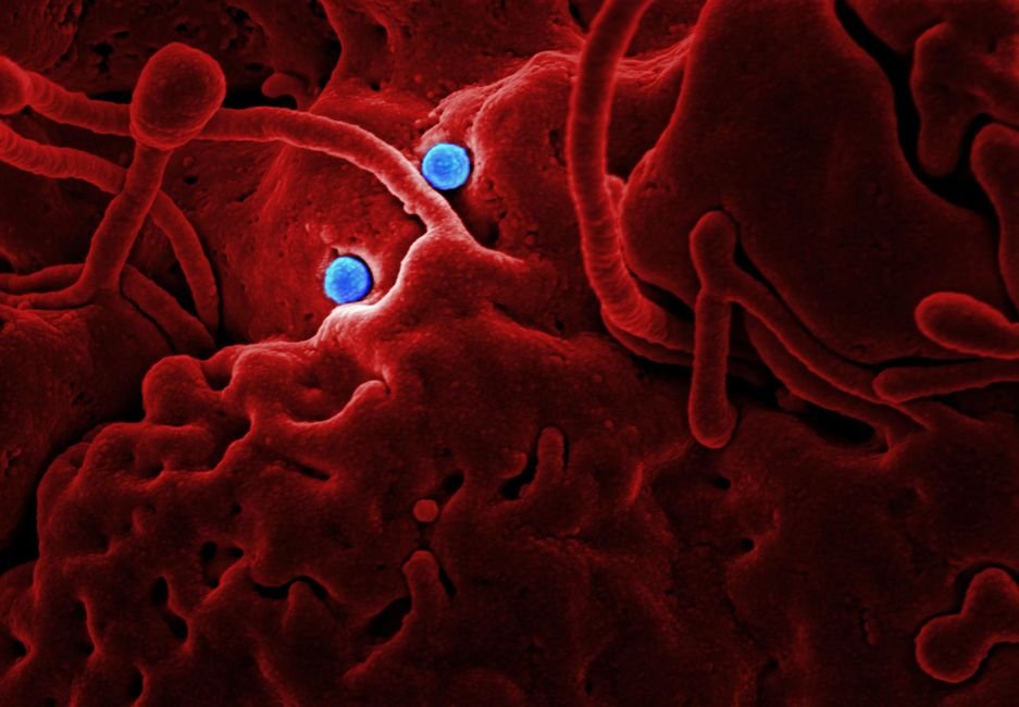 DR Congo Ebola Outbreak: Funeral Rituals Under Scrutiny Amidst Rising Death Toll Detailed microscopic image showing red structures and blue virus particles.